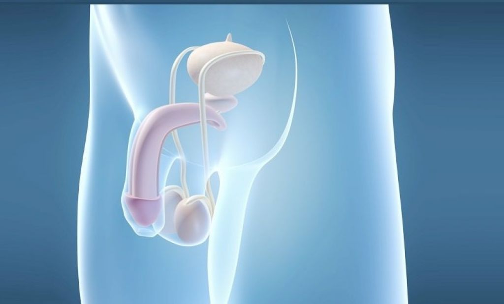 Implantation of prostheses is a surgical method of enlarging the male penis